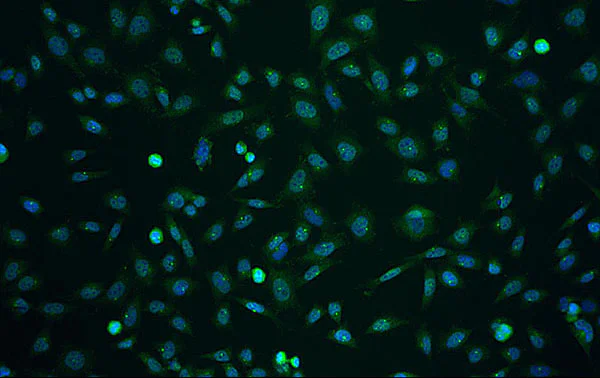 Immunocytochemistry/ Immunofluorescence - Anti-ITM2A antibody (AB203620)
