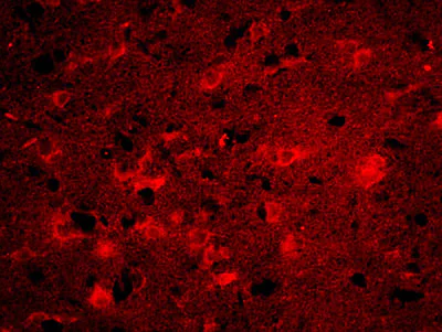 Immunohistochemistry (Formalin/PFA-fixed paraffin-embedded sections) - Anti-ITM2A antibody (AB203620)