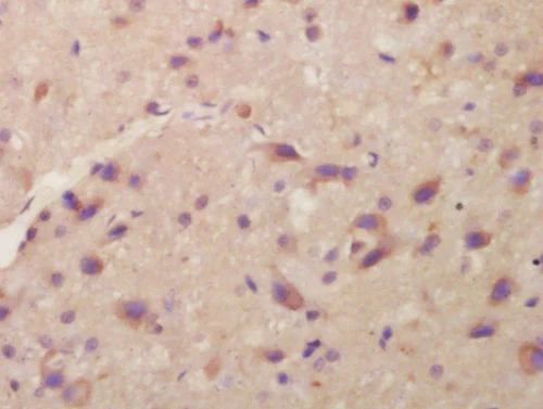Immunohistochemistry (Formalin/PFA-fixed paraffin-embedded sections) - Anti-ITM2A antibody (AB203620)