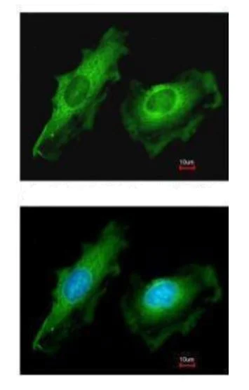 Immunocytochemistry/ Immunofluorescence - Anti-ITM2B antibody (AB101522)