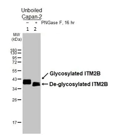 Western blot - Anti-ITM2B antibody (AB101522)