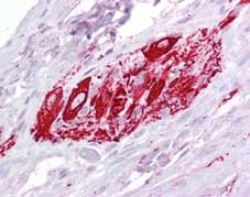 Immunohistochemistry (Formalin/PFA-fixed paraffin-embedded sections) - Anti-ITM2B antibody (AB129282), expandable thumbnail