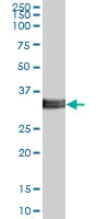 Western blot - Anti-ITM2B antibody (AB89352)