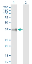 Western blot - Anti-ITM2B antibody (AB89352)