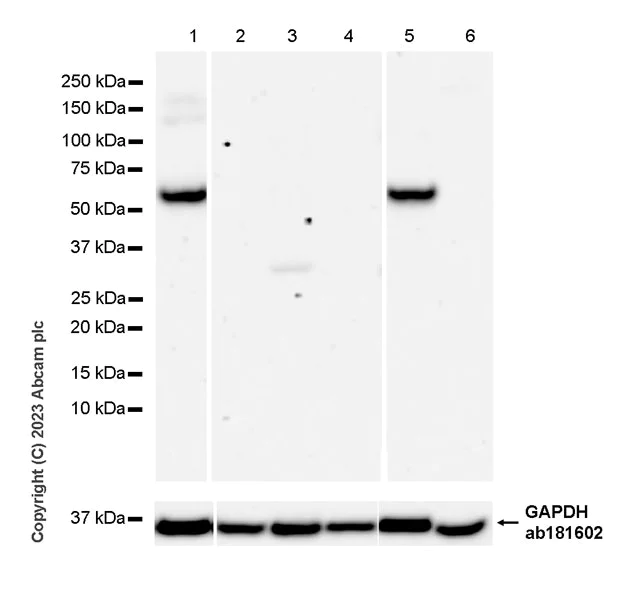 Western blot - Anti-ITM2B antibody [EPR27849-47] (AB315234)