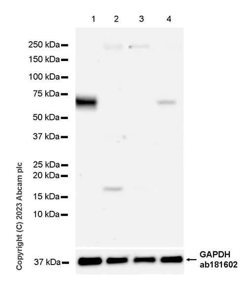 Western blot - Anti-ITM2B antibody [EPR27849-47] (AB315234)