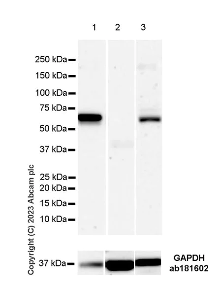 Western blot - Anti-ITM2B antibody [EPR27849-47] (AB315234)