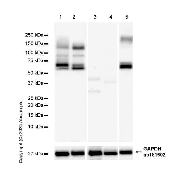Western blot - Anti-ITM2B antibody [EPR27849-47] (AB315234)