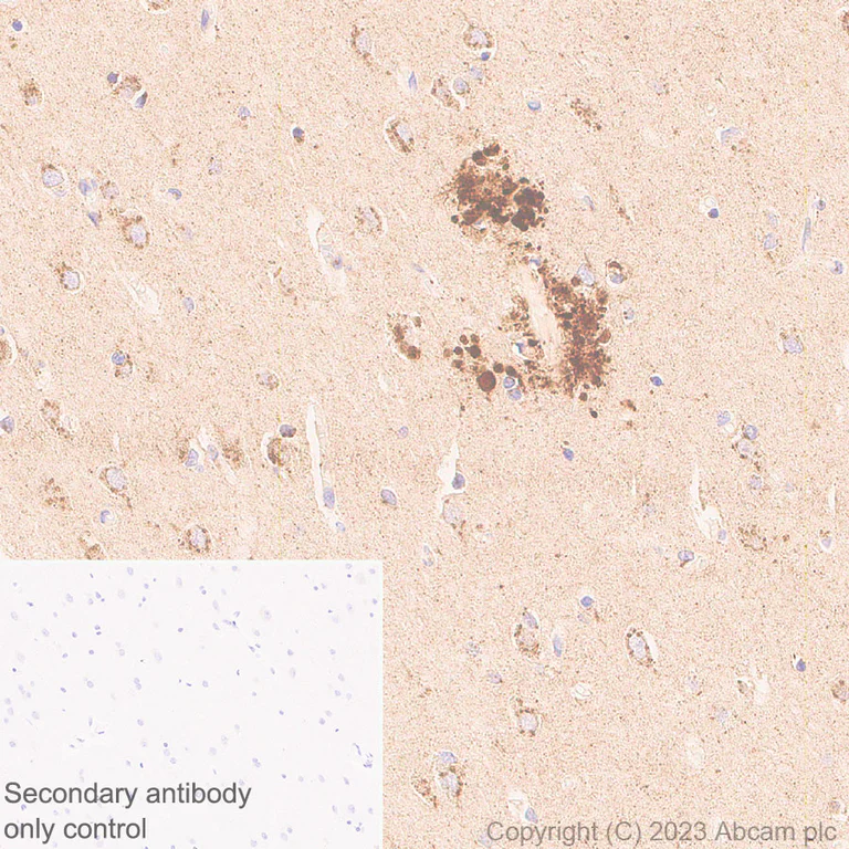 Immunohistochemistry (Formalin/PFA-fixed paraffin-embedded sections) - Anti-ITM2B antibody [EPR27849-60] - BSA and Azide free (AB314655)