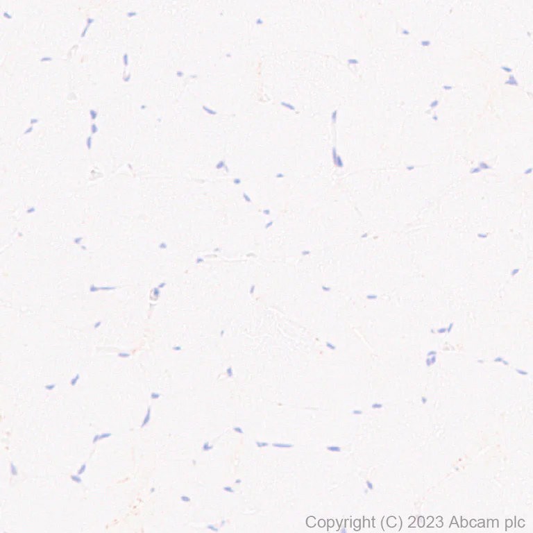 Immunohistochemistry (Formalin/PFA-fixed paraffin-embedded sections) - Anti-ITM2B antibody [EPR27849-60] - BSA and Azide free (AB314655)