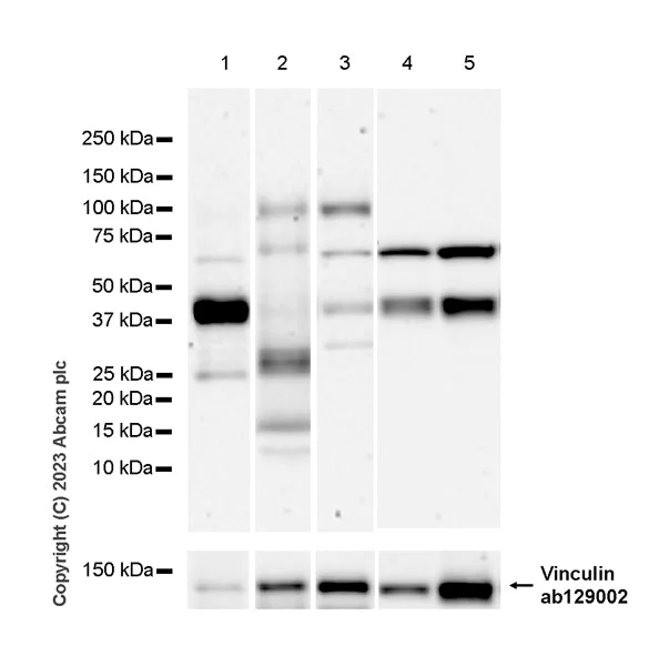 Western blot - Anti-ITM2B antibody [EPR27849-60] - BSA and Azide free (AB314655)