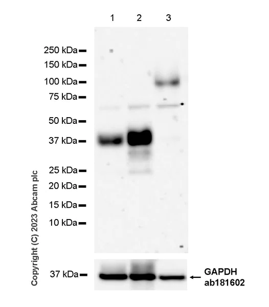 Western blot - Anti-ITM2B antibody [EPR27849-60] - BSA and Azide free (AB314655)
