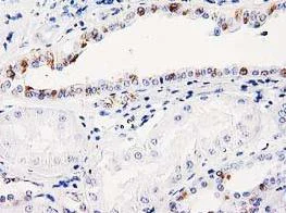 Immunohistochemistry (Formalin/PFA-fixed paraffin-embedded sections) - Anti-ITM2B antibody [OTI1C11] (AB119044)