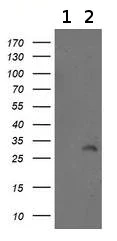 Western blot - Anti-ITM2B antibody [OTI1C11] (AB119044)