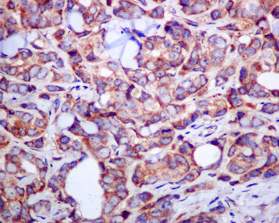 Immunohistochemistry (Formalin/PFA-fixed paraffin-embedded sections) - Anti-ITPA antibody [EPR8780] (AB134937)