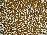 Immunohistochemistry (Formalin/PFA-fixed paraffin-embedded sections) - Anti-ITPK1 antibody [EPR10631] (AB175222)