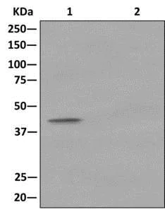 Immunoprecipitation - Anti-ITPK1 antibody [EPR10631] - BSA and Azide free (AB249873)