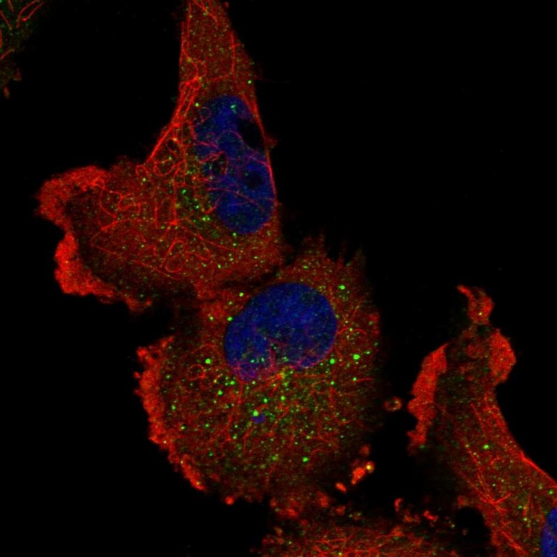 Immunocytochemistry/ Immunofluorescence - Anti-ITPKA antibody (AB251867), expandable thumbnail