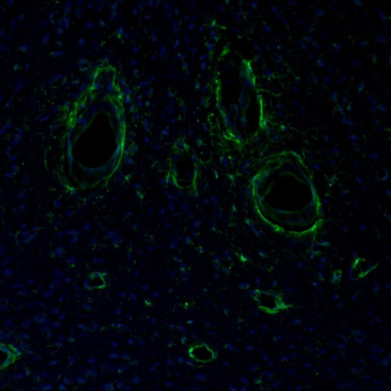 Immunohistochemistry (Formalin/PFA-fixed paraffin-embedded sections) - Anti-ITPKA antibody (AB251867), expandable thumbnail