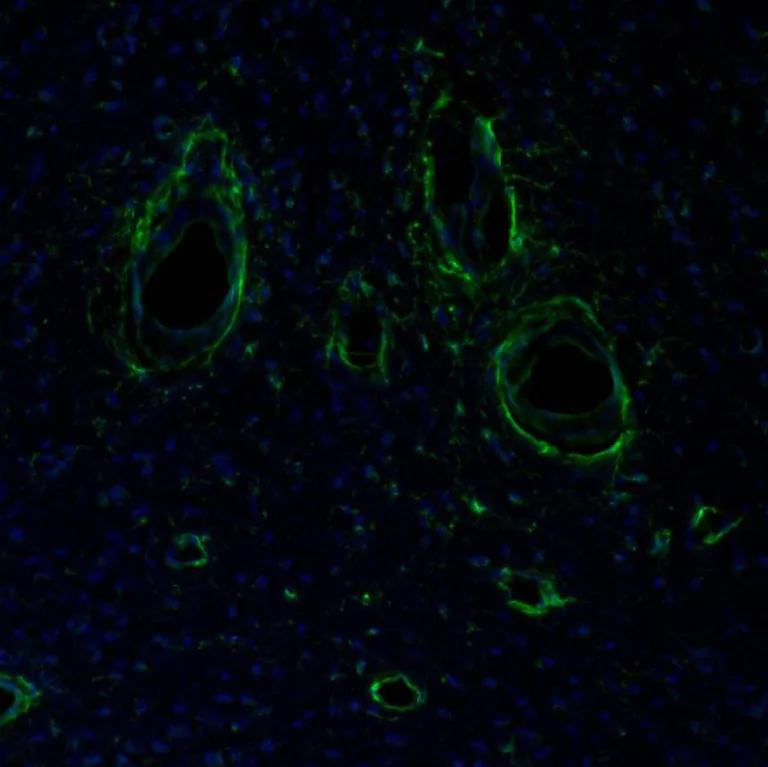Immunohistochemistry (Formalin/PFA-fixed paraffin-embedded sections) - Anti-ITPKA antibody (AB251867)