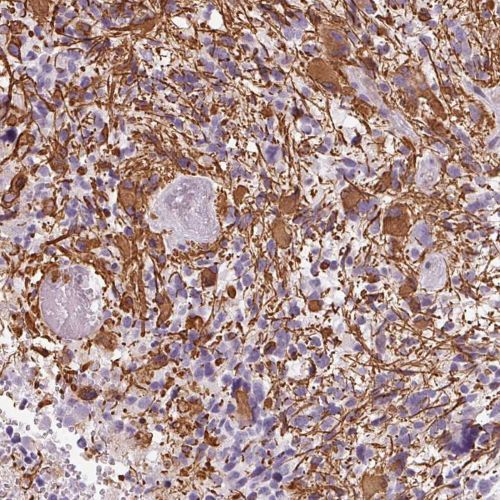 Immunohistochemistry (Formalin/PFA-fixed paraffin-embedded sections) - Anti-ITPKA antibody (ab251867), expandable thumbnail