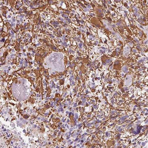 Immunohistochemistry (Formalin/PFA-fixed paraffin-embedded sections) - Anti-ITPKA antibody (AB251867)