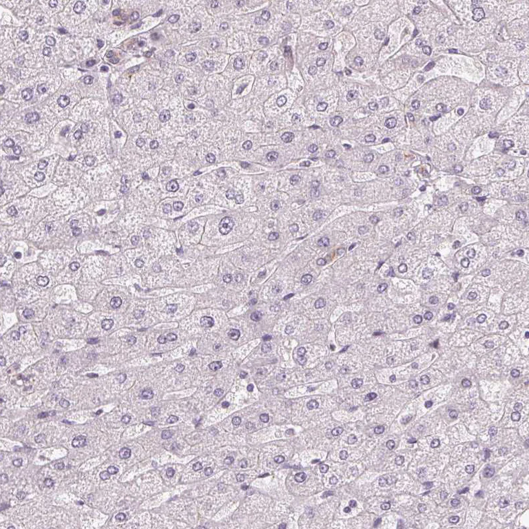 Immunohistochemistry (Formalin/PFA-fixed paraffin-embedded sections) - Anti-ITPKA antibody (AB251867)