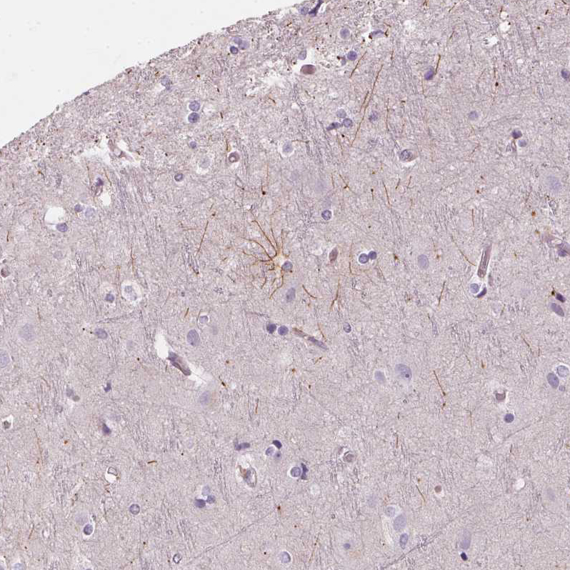 Immunohistochemistry (Formalin/PFA-fixed paraffin-embedded sections) - Anti-ITPKA antibody (AB251867), expandable thumbnail