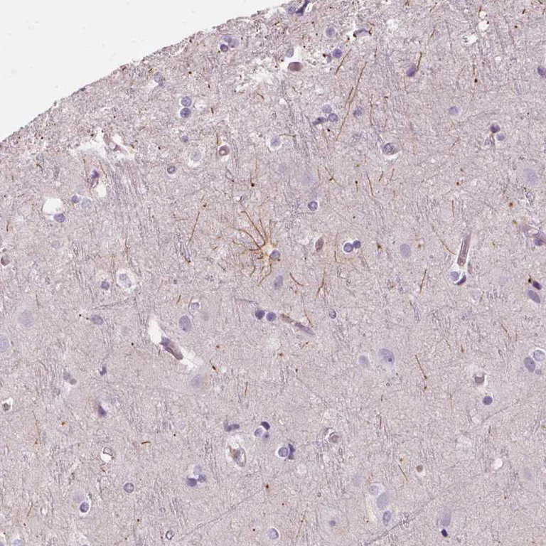 Immunohistochemistry (Formalin/PFA-fixed paraffin-embedded sections) - Anti-ITPKA antibody (AB251867)