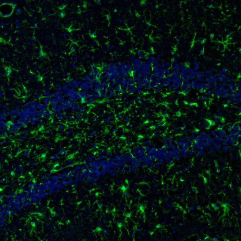 Immunohistochemistry (Formalin/PFA-fixed paraffin-embedded sections) - Anti-ITPKA antibody (AB251867)