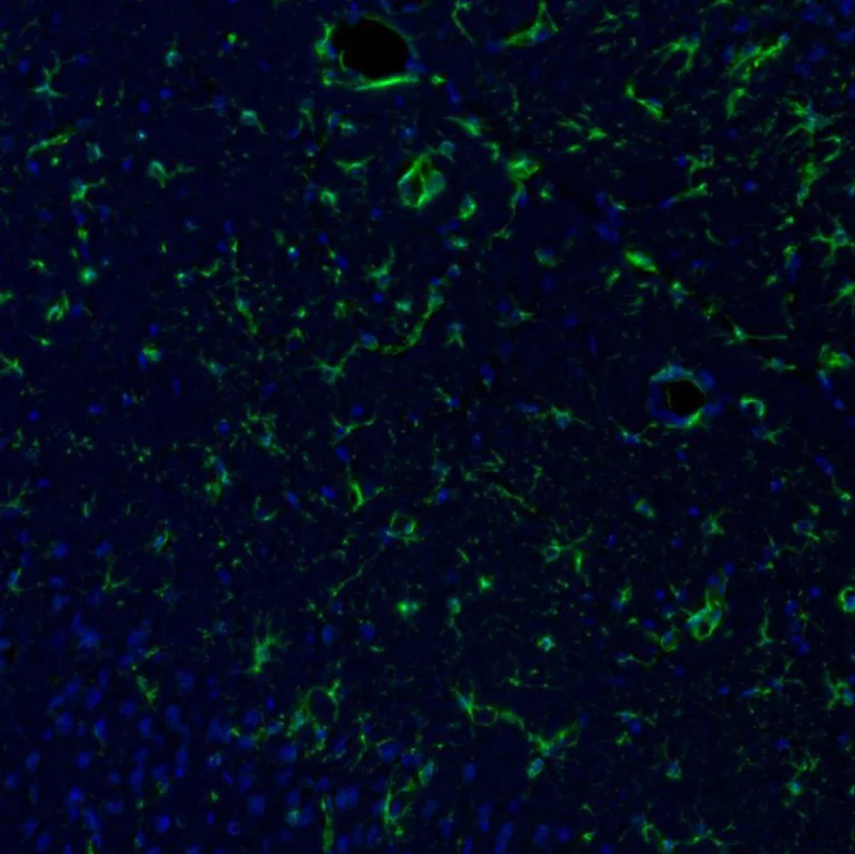 Immunohistochemistry (Formalin/PFA-fixed paraffin-embedded sections) - Anti-ITPKA antibody (AB251867)