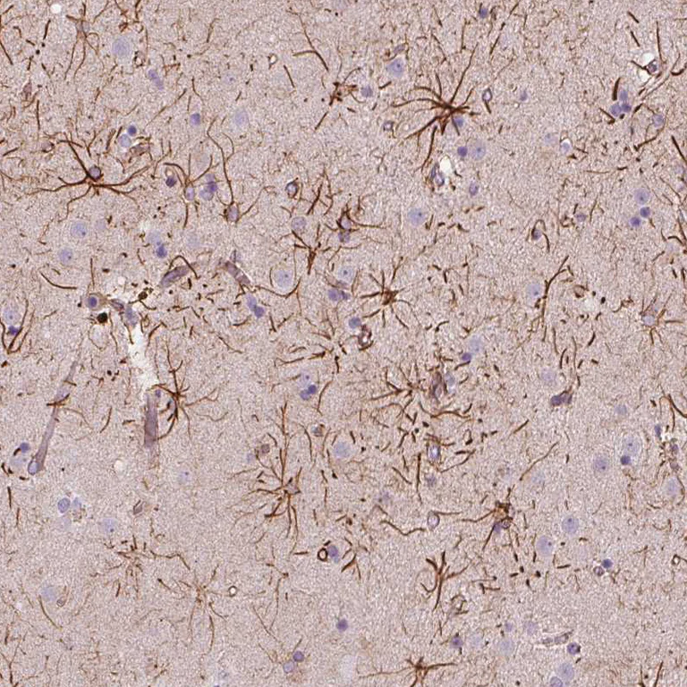 Immunohistochemistry (Formalin/PFA-fixed paraffin-embedded sections) - Anti-ITPKA antibody (AB251867)