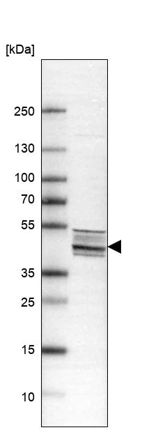 Western blot - Anti-ITPKA antibody (AB251867)