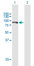 Western blot - Anti-ITPKB antibody (AB171984)
