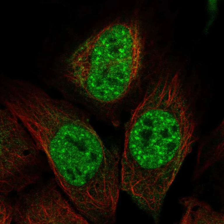 Immunocytochemistry/ Immunofluorescence - Anti-ITPKC antibody (AB188007)