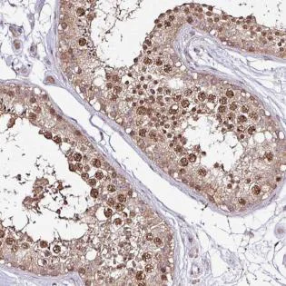 Immunohistochemistry (Formalin/PFA-fixed paraffin-embedded sections) - Anti-ITPKC antibody (AB188007)