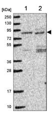 Western blot - Anti-ITPKC antibody (AB188007)