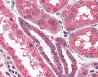 Immunohistochemistry (Formalin/PFA-fixed paraffin-embedded sections) - Anti-ITPR2 antibody (AB104550)