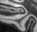 Immunohistochemistry (Frozen sections) - Anti-ITPR2 antibody (AB5805)