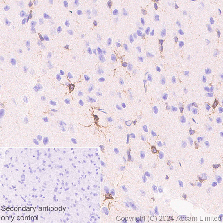 Immunohistochemistry (Formalin/PFA-fixed paraffin-embedded sections) - Anti-ITPR2 antibody [EPR28319-63] (AB320725)