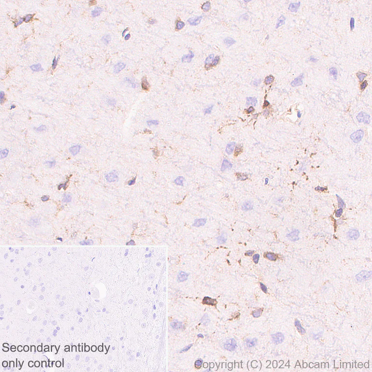 Immunohistochemistry (Formalin/PFA-fixed paraffin-embedded sections) - Anti-ITPR2 antibody [EPR28319-63] (AB320725)