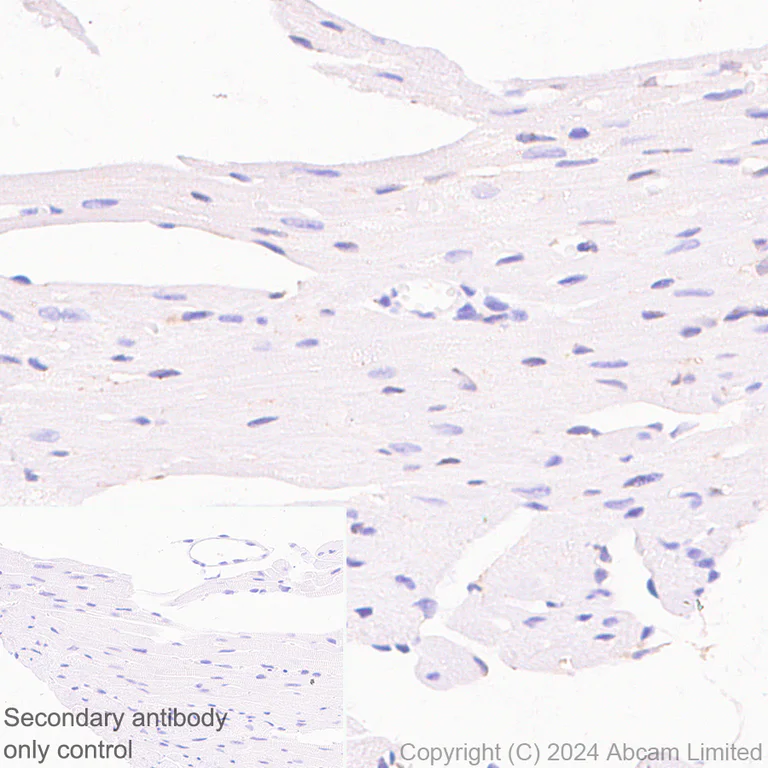 Immunohistochemistry (Formalin/PFA-fixed paraffin-embedded sections) - Anti-ITPR2 antibody [EPR28319-63] (AB320725)