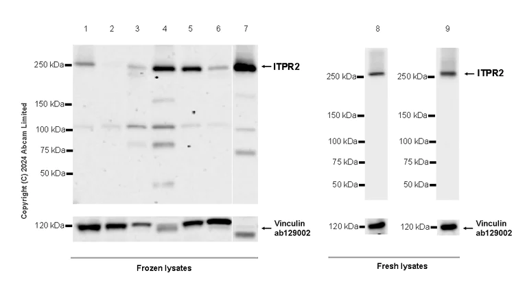 Western blot - Anti-ITPR2 antibody [EPR28319-63] (AB320725)
