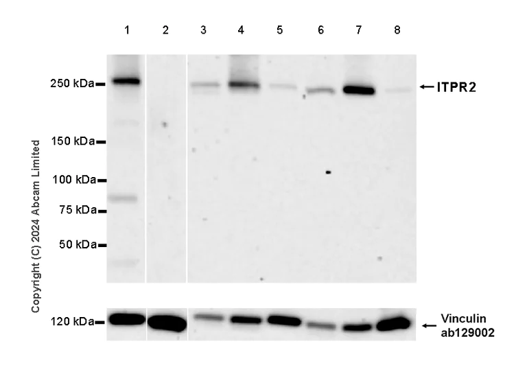 Western blot - Anti-ITPR2 antibody [EPR28319-63] (AB320725)