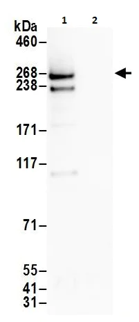 Immunoprecipitation - Anti-ITPR3 antibody (AB264282)