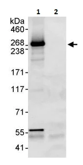 Immunoprecipitation - Anti-ITPR3 antibody (AB264283)