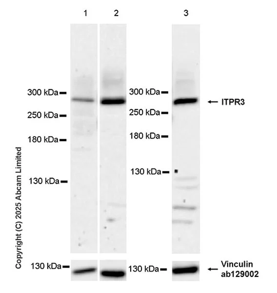 Western blot - Anti-ITPR3 antibody [EPR25276-304] (AB325503)