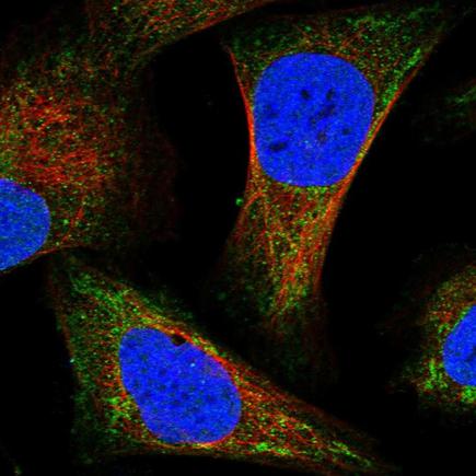 Immunocytochemistry/ Immunofluorescence - Anti-IVD antibody (AB243509), expandable thumbnail