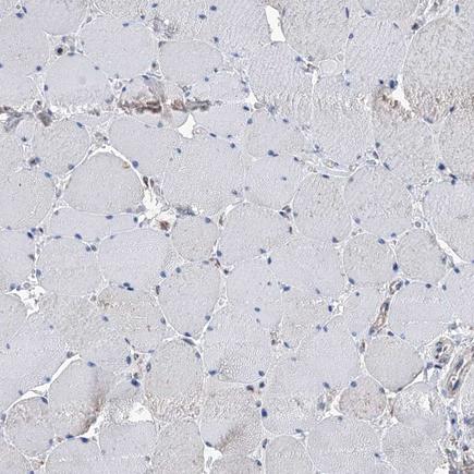 Immunohistochemistry (Formalin/PFA-fixed paraffin-embedded sections) - Anti-IVD antibody (AB243509), expandable thumbnail
