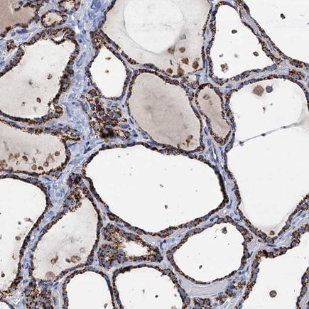Immunohistochemistry (Formalin/PFA-fixed paraffin-embedded sections) - Anti-IVD antibody (AB243509), expandable thumbnail